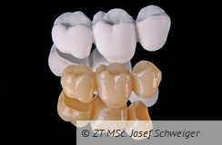 Abb. 1: Zirkonoxid hat in den letzten 20 Jahren die Zahntechnik erheblich verändert und die CAD/CAM-Technologie im Dentalbereich stark verbreitet.