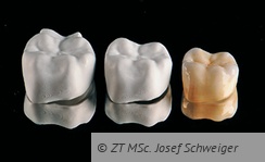 Abb. 13: Die drei Stadien einer additiv gefertigten Krone aus Zirkonoxid: Grünling – Weißling – dichtgesinterte Krone nach dem Malfarben- und Glasurmassebrand.