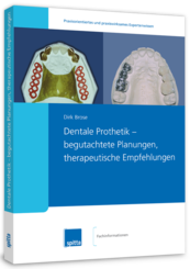 Dentale Prothetik - begutachtete Planungen, therapeutische Empfehlungen (eBook) 1000712105